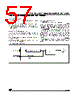 ST92185B2 Datasheet HTML 57Page - STMicroelectronics 